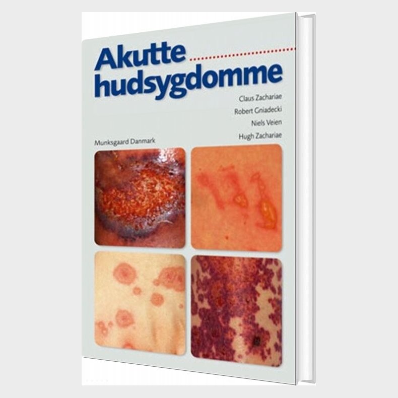 Akutte Hudsygdomme - Robert Gniadecki - Bog