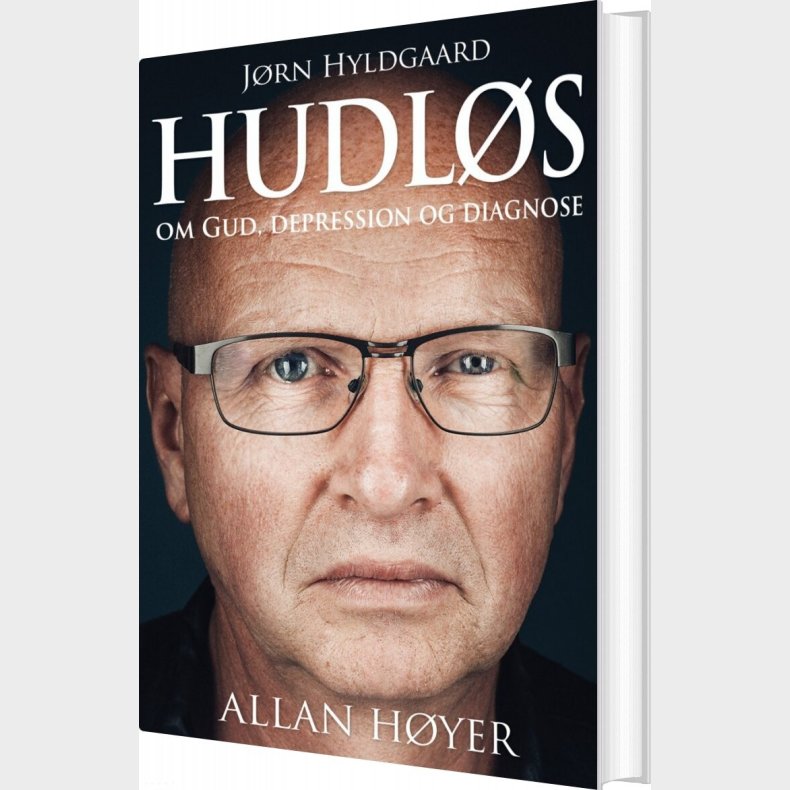 Hudl�s - Allan H�yer - Bog