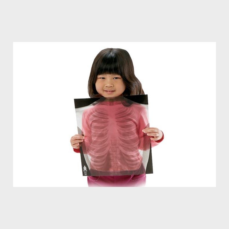 Roylco | Rntgenbilleder - Menneske, 18 stk